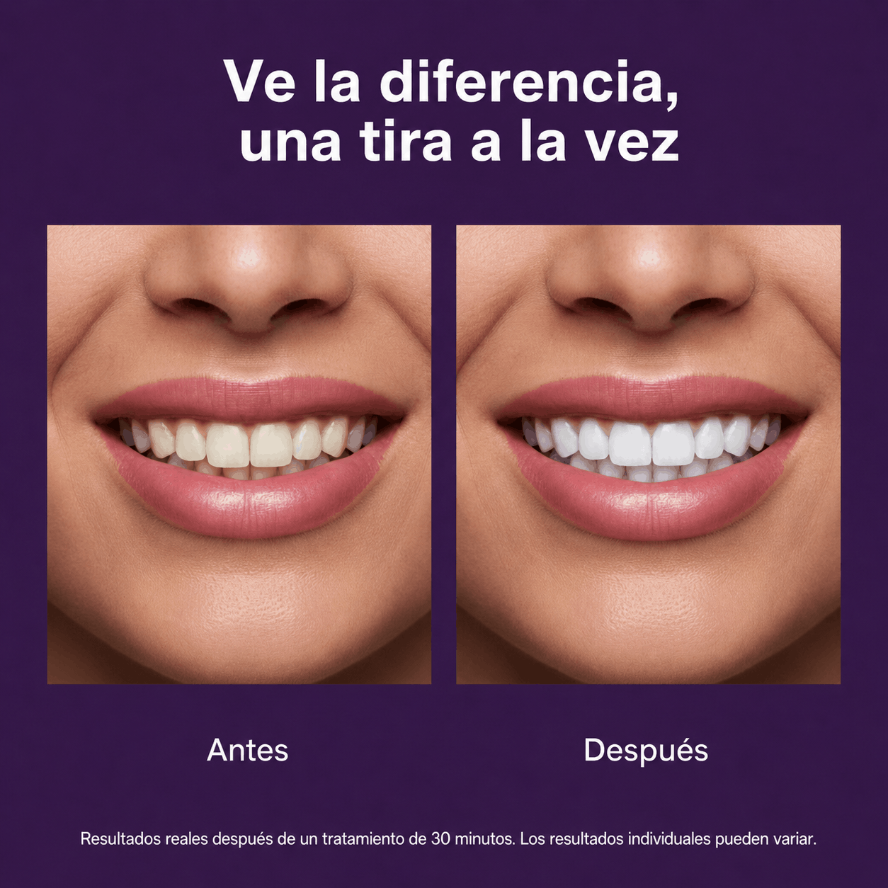Tiras Moradas Blanqueadoras de Dientes