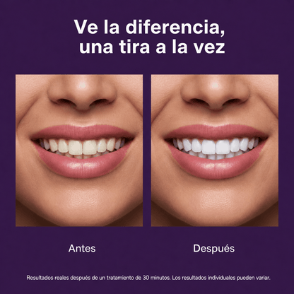 Tiras Moradas Blanqueadoras de Dientes