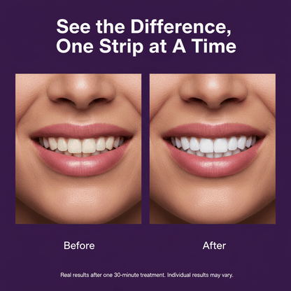 Purple Teeth Whitening Strips